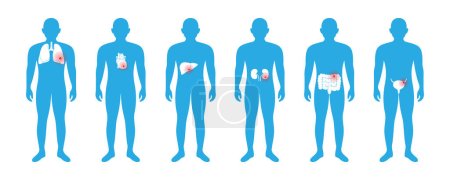 Cuerpo masculino con dolores de órganos internos. Pulmones, corazón, hígado, riñones, intestinos, vejiga. Cartel médico del donante. Diferentes íconos de dolor corporal aislados sobre fondo blanco.