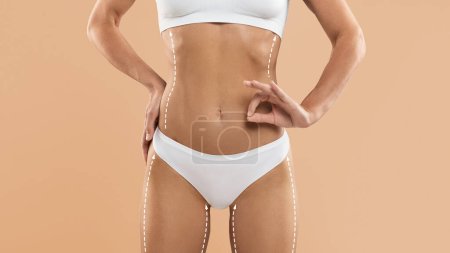 Photo for Slimming Treatment. Young Slim Female In Underwear With Lifting Lines On Skin Showing Ok Gesture, Standing Isolated On Beige Background, Lady With Sporty Figure Recommending Beauty Precedure, Collage - Royalty Free Image