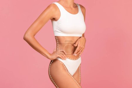 Photo for Body Sculpting. Slim Young Woman In Underwear With Drawn Lifting Lines On Skin Standing Isolated On Pink Background, Unrecognizable Female With Sporty Figure In White Top And Panties, Collage - Royalty Free Image