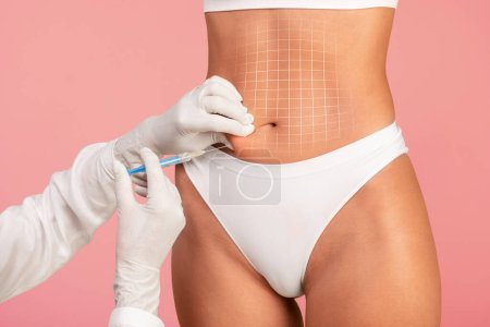 Photo for Beautician Doctor Wearing Gloves Making Lypolisis Injection To Female Belly, Unrecognizable Woman In Underwear With Drawn Mesh On Abdomen Getting Beauty Shot For Slimming, Pink Background, Collage - Royalty Free Image