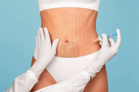 Photo for Mesotherapy Concept. Unrecognizable Doctor Taking Injection To Abdomen Of Young Woman, Beautician Wearing Gloves Making Aesthetic Procedure To Flat Female Belly With Drawn Mesh On It, Collage - Royalty Free Image