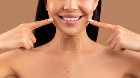 Foto de Concepto de cuidado oral. Hermosa mujer joven desnuda señalando su sonrisa con dos dedos, Dama alegre irreconocible mostrando dientes blancos, de pie sobre el fondo del estudio beige, tiro recortado, primer plano - Imagen libre de derechos