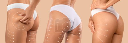 Photo for Beauty treatment result. Young european women in bikini with slim body with lines for figure shaping or drainage massage isolated on beige background, studio. Plastic surgery, anti cellulite procedure - Royalty Free Image