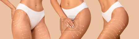 Photo for Young caucasian women in bikini with perfect skin with lines for body shaping, drainage massage isolated on beige background, studio. Contouring plastic surgery, fitness workout result and beauty care - Royalty Free Image