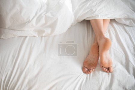 Téléchargez les photos : Legs of young european woman alone lies on white bed at weekend in bedroom, top view, cropped. Sleep well, health care, rest and relax at home, skin care, fungus treatment, good morning, ad and offer - en image libre de droit