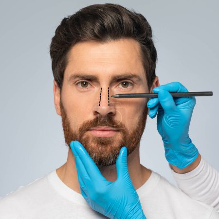 Rhinoplasty concept. Handsome middle aged man with marking on his nose standing on grey studio background, closeup, cropped. Doctors gloved hand making marks on the patients face