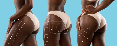 Téléchargez les photos : Young african american women in beige lingerie with perfect skin with lines for body shaping or drainage massage, isolated on blue background. Perfect fit female, plastic surgery, brazilian butt lift - en image libre de droit