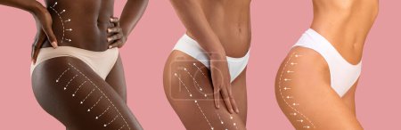 Téléchargez les photos : Millénaire différentes femmes en bikini avec un corps mince avec des lignes pour le façonnage de la figure ou massage de drainage et de beauté, isolé sur fond rose. Cosmétologie, chirurgie plastique, traitement de la cellulite - en image libre de droit