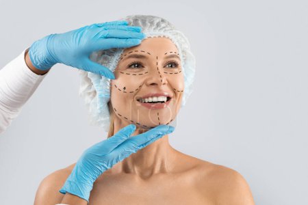 Foto de Cheerful excited middle aged woman in medical hat with pre surgery marks on her face looking at copy space for ad and smiling, surgeon hands in blue gloves touching female skin - Imagen libre de derechos