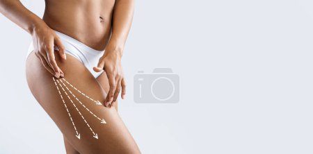 Photo for Young slim black female in white lingerie enjoys slimming result, touches perfect leg with abstract lines, does drainage massage, isolated on gray wall background, studio. Body care, diet, treatment - Royalty Free Image