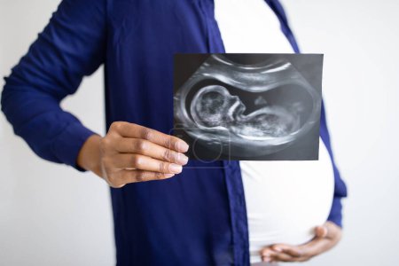 Foto de Millennial africana americana embarazada dama con gran vientre muestra imagen de ultrasonido del bebé en el interior de la sala de estar. Esperando bebé, amor, cuidado de la salud y la medicina, recortado - Imagen libre de derechos