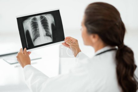 Woman doctor hands holding patient chest x-ray film before treatment. Image lung at radiology department in hospital, back view. Computed tomography, CT, check-up, healthcare concept