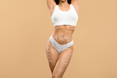 Photo for Body Contouring Concept. Cropped Shot Of Slim Female Torso With Drawn Lifting Up Lines On It, Unrecognizable Woman In White Underwear With Perfect Figure Standing On Beige Studio Background, Collage - Royalty Free Image