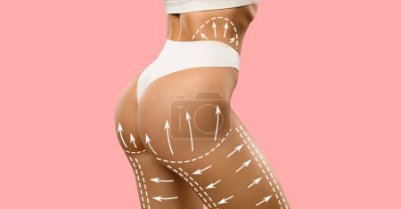 Photo for Cropped of slim lady in white lingerie enjoys weight loss result with abstract lines on perfect body, isolated on pink wall background, studio. Drainage massage and beauty care - Royalty Free Image