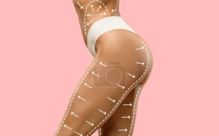 Photo for Body shaping concept. Side view of woman in white underwear showing her beautiful hips with sculpting lines on skin, pink studio background, collage - Royalty Free Image