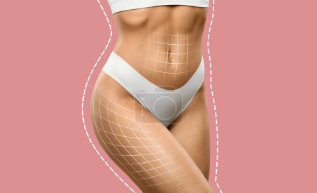 Photo for Cropped of well-fit woman in white underwear with contouring lines, symbolizing body shaping or anti-cellulite cosmetic treatment over pink studio background, collage - Royalty Free Image
