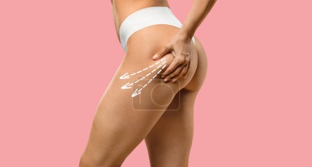 Photo for Cropped of slim young woman in underwear doing anti-cellulite massage on leg, isolated on pink studio background, panorama with copy space. Beauty care, lifting, body love and treatment - Royalty Free Image