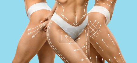 Photo for Lifting and tightening concept, collage. Cropped of three young ladies in white panties posing with massage lines and arrows on their bodies over blue studio background, web-banner - Royalty Free Image