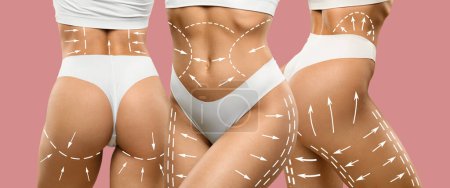 Photo for Body shaping, skin tightening, fighting local fat deposits and cellulite treatment, web-banner, collage. Cropped of athletic women bodies with sculpting white lines, panorama with copy space on pink - Royalty Free Image