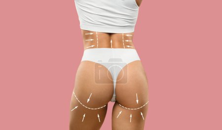 Foto de Vista posterior de la mujer atlética en ropa interior blanca con líneas en el cuerpo posando sobre fondo rosa, espacio de copia, collage para el concepto de escultura corporal. Tratamiento de belleza, masaje anticelulítico - Imagen libre de derechos
