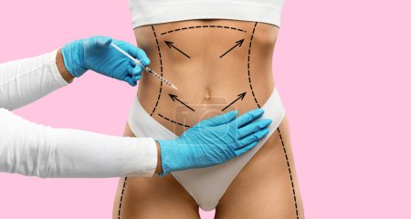 Photo for Non-surgical body lifting sculpturing concept. Unrecognizable young woman in underwear getting injection in belly, isolated on pink studio background, collage, web-banner - Royalty Free Image
