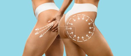 Photo for Cropped of two slim young women in underwear doing anti-cellulite massage on hips, isolated on blue studio background, panorama with copy space. Beauty care, lifting, body love and treatment - Royalty Free Image