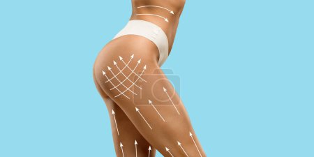 Photo for Body shaping, skin tightening, fighting local fat deposits and cellulite treatment, web-banner, collage. Cropped of athletic woman body with sculpting white lines, panorama with copy space on blue - Royalty Free Image