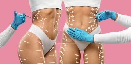 Photo for Cosmetic Procedure for Body Sculpting. Gloved hands of doctors performing a cosmetic injection on marked bodies of women patients, pink background, concept of cosmetic surgery and body contouring - Royalty Free Image