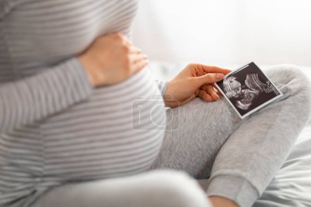 Foto de Un momento conmovedor cuando una futura madre mira la imagen de ultrasonido de su hijo por nacer, sintiendo la conexión - Imagen libre de derechos