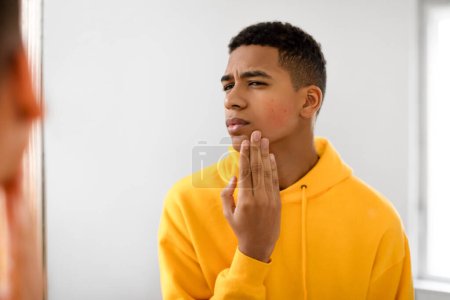 Téléchargez les photos : Focalisé noir adolescent gars en sweat à capuche jaune examine attentivement sa joue pour les signes d'allergies devant le miroir dans la pièce bien éclairée intérieur - en image libre de droit