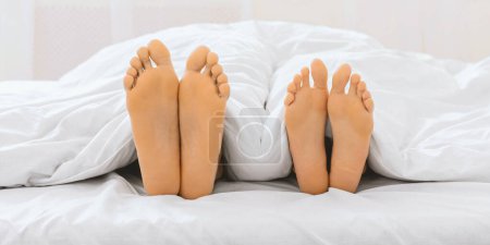Photo for A playful and intimate view of two pairs of feet with painted toenails, suggesting fun and femininity - Royalty Free Image