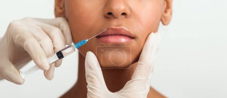 Dieses Bild konzentriert sich auf einen präzisen kosmetologischen Eingriff an einer afrikanisch-amerikanischen Damenlippe, ästhetische Medizin, beschnitten