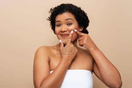 Young Brazilian woman wrapped in towel squeezing pimples on her face, isolated on beige studio background. Acne prone skin concept