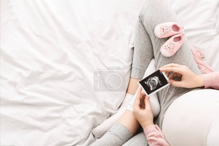 A pregnant woman lounges on a bed in the morning, gently holding an ultrasound picture of her baby, with baby shoes nearby, view above, copy space