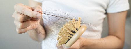 Foto de El concepto de caída del cabello. Impresionada mujer asiática mirando muchos cabellos perdidos en su mano y peine. - Imagen libre de derechos