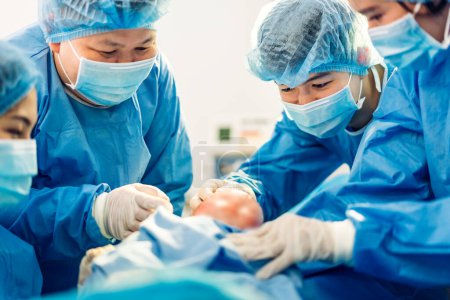 Téléchargez les photos : Anesthésiologiste professionnel médecin équipe médicale et assistant effectue césarienne bébé et tenir le bébé accouchant avec du matériel chirurgical dans la salle d'opération moderne de l'hôpital - en image libre de droit