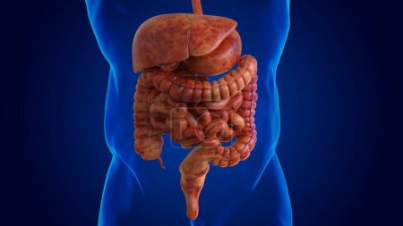 Téléchargez les photos : Système digestif humain endommagé pour concept médical Illustration 3D - en image libre de droit