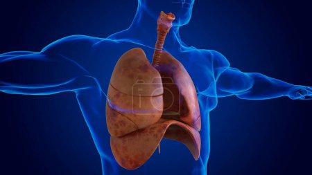 Foto de Daño humano anatomía pulmonar para el concepto médico ilustración 3D - Imagen libre de derechos