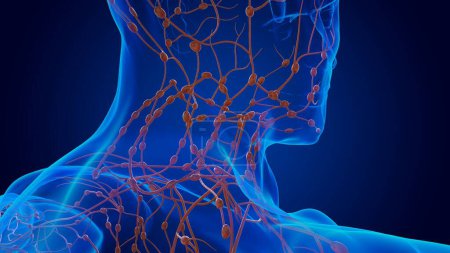 Téléchargez les photos : Lésions humaines anatomie des ganglions lymphatiques pour concept médical Illustration 3D - en image libre de droit
