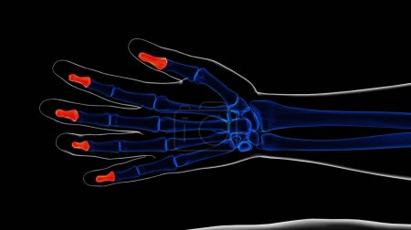 Foto de Anatomía ósea distal de las falanges de la mano del esqueleto humano para la ilustración 3D del concepto médico - Imagen libre de derechos