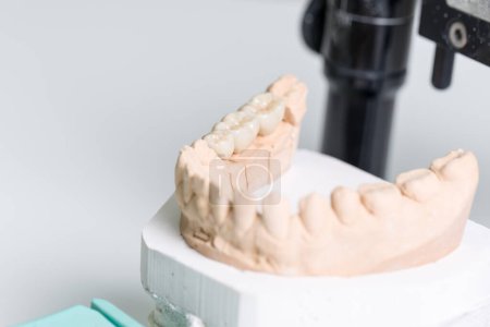 Foto de Primer plano de un implante dental en una silla articuladora / protésica en un laboratorio dental - Imagen libre de derechos