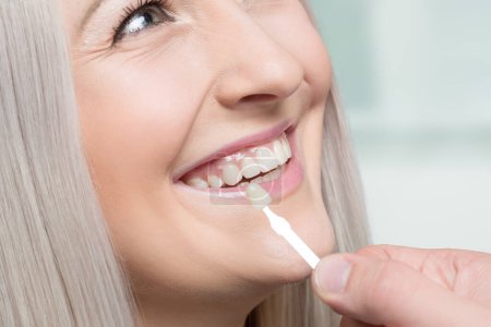 Primer plano del dentista utilizando la guía de sombra en la boca de la mujer para comprobar la chapa de los dientes