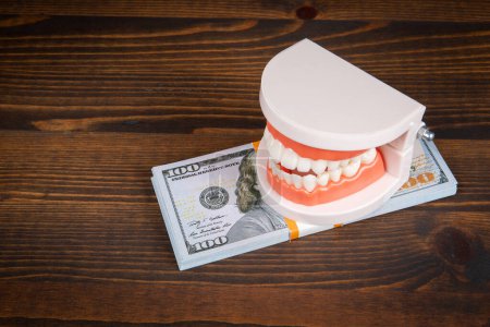 Photo for Banknotes in a pile, a model of teeth on top on wooden background. Dental costs concept. - Royalty Free Image