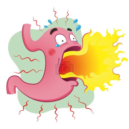 Illustration for Stomach mascot with heartburn and burning. Anatomy and symptom. Ideal for training and education materials - Royalty Free Image