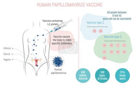 Ilustración de Infografía sobre cómo funcionan las vacunas contra el virus del papiloma humano y los tipos de vacunas - Imagen libre de derechos