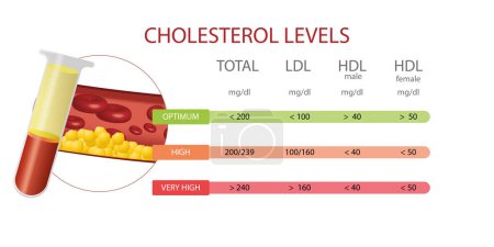 Téléchargez les illustrations : Infographie des niveaux de cholestérol, optimal bas, et très élevé Avec l'image de l'artère et le cholestérol déposé en elle. Eps vectoriels 10 - en licence libre de droit