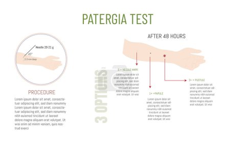 Illustration for Infographic explaining the Patergia test to detect Behet's disease .Arm with needle puncture and possible skin reactions. - Royalty Free Image