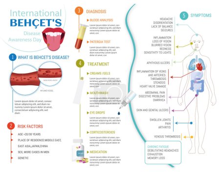 Ilustración de Infografía de la enfermedad de Behet, síntomas, causas, factores de riesgo y tratamiento sobre fondo blanco. - Imagen libre de derechos