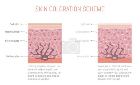 Téléchargez les illustrations : Schéma de coloration de la peau, pour les peaux claires et foncées. Diagramme d'un mélanocyte. - en licence libre de droit