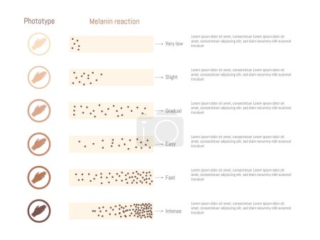 Ilustración de Diagrama de fototipos y reacción a la melanina.Vector EPS - Imagen libre de derechos